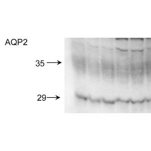 Western blot analysis of rat kidney inner medullary homogenates showing detection of Aquaporin 2 protein using Anti-Aquaporin 2 Antibody (A304986) at 1:2000. Showing glycosylated and non-glycosylated bands