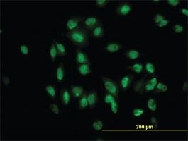 Anti-TULP2 Mouse Monoclonal Antibody [clone: 2B5]