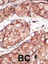 Anti-TLR5 Rabbit Polyclonal Antibody (PE (Phycoerythrin))