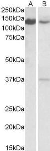 Anti-SRRT antibody