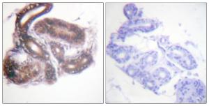 Immunohistochemical analysis of paraffin-embedded human skin tissue using Anti-HDAC3 Antibody. The right hand panel represents a negative control, where the antibody was pre-incubated with the immunising peptide