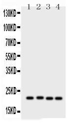 Anti-SOCS2 Rabbit Polyclonal Antibody