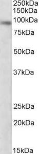 Anti-DTX3 Antibody (A84730) (0.3µg/ml) staining of NIH3T3 lysate (35µg protein in RIPA buffer). Primary incubation was 1 hour. Detected by chemiluminescence.