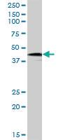 Anti-HOXB9 Mouse Polyclonal Antibody