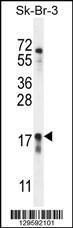 Anti-CA115 Rabbit Polyclonal Antibody (FITC (Fluorescein Isothiocyanate))