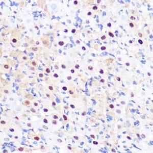 Immunohistochemistry analysis of paraffin-embedded rat ovary using Anti-LXR alpha Antibody [ARC0877] (A307802) at a dilution of 1:100 (40x lens). Perform microwave antigen retrieval with 10 mM PBS buffer pH 7.2 before commencing with IHC staining protocol.