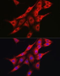 Immunofluorescence analysis of PC-12 cells using Anti-IRE1 Antibody (A92812) at a dilution of 1:100 (40x lens) DAPI was used to stain the cell nuclei (blue)