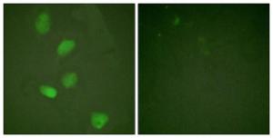 Immunofluorescence analysis of HeLa cells using Anti-HDAC3 Antibody. The right hand panel represents a negative control, where the antibody was pre-incubated with the immunising peptide