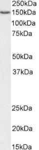 Anti-SRRT antibody