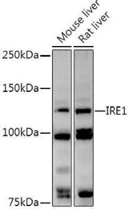 Western blot analysis of extracts of various cell lines, using Anti-IRE1 Antibody (A92812) at 1:1,000 dilution The secondary antibody was Goat Anti-Rabbit IgG H&L Antibody (HRP) at 1:10,000 dilution Lysates/proteins were present at 25 µg per lane