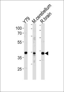 Anti-NEUROD1 Rabbit Polyclonal Antibody (AP (Alkaline Phosphatase))