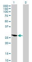 Anti-HOXB9 Mouse Polyclonal Antibody