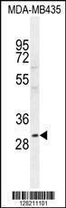 Anti-CLEC10A Rabbit Polyclonal Antibody