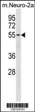 Anti-BRD9 Rabbit Polyclonal Antibody (Biotin)