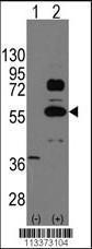 Anti-SOX9 Rabbit Polyclonal Antibody (Biotin)