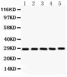 Anti-SRSF1 Rabbit Polyclonal Antibody