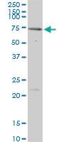 Anti-MEN1 Mouse Polyclonal Antibody