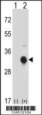 Anti-KLK10 Rabbit Polyclonal Antibody (FITC (Fluorescein Isothiocyanate))