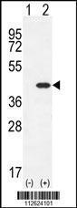 Anti-CLEC11A Rabbit Polyclonal Antibody (APC (Allophycocyanin))