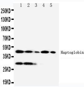 Anti-Haptoglobin Rabbit Polyclonal Antibody