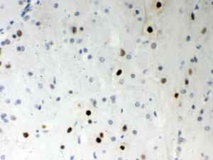 Anti-SRSF1 Rabbit Polyclonal Antibody