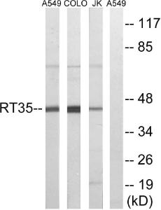 Western blot analysis of lysates from Jurkat, COLO, and A549 cells using Anti-MRPS35 Antibody. The right hand lane represents a negative control, where the antibody is blocked by the immunising peptide