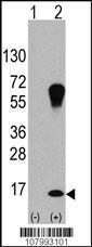 Anti-MAP1LC3A Rabbit Polyclonal Antibody (APC (Allophycocyanin))