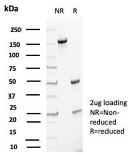 Anti-p27 Kip1 antibody