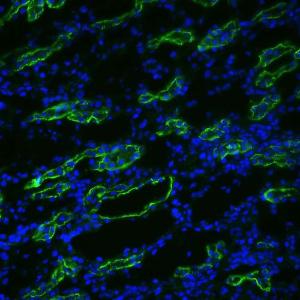 Anti-Aquaporin 3 antibody