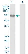 Anti-MEN1 Mouse Polyclonal Antibody