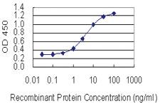 Anti-KIF21B Mouse Monoclonal Antibody [clone: 4C12]