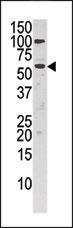 Anti-CHKA Rabbit Polyclonal Antibody (HRP (Horseradish Peroxidase))