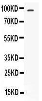 Anti-STAT6 Rabbit Polyclonal Antibody