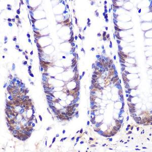 Immunohistochemistry analysis of paraffin-embedded human colon tissue using Anti-LXR alpha Antibody [ARC0877] (A307802) at a dilution of 1:100 (40x lens). Perform microwave antigen retrieval with 10 mM PBS buffer pH 7.2 before commencing with IHC staining protocol.