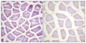 Immunohistochemical analysis of paraffin-embedded human skeletal muscle using Anti-Parkin (phospho Ser131) Antibody. The right hand panel represents a negative control, where the antibody was pre-incubated with the immunising peptide