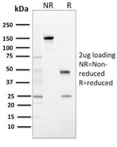 SDS-PAGE analysis of Anti-14-3-3 Sigma Antibody [CPTC-SFN-2] under non-reduced and reduced conditions; showing intact IgG and intact heavy and light chains, respectively. SDS-PAGE analysis confirms the integrity and purity of the antibody