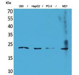 Western blot analysis of 293, HepG PC 3, M21 cells using Anti-FGF6 Antibody