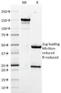 SDS-PAGE analysis of Anti-VCAM1 Antibody [1.4C3] under non-reduced and reduced conditions; showing intact IgG and intact heavy and light chains, respectively. SDS-PAGE analysis confirms the integrity and purity of the antibody.