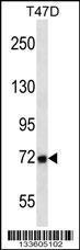 Anti-MMP2 Rabbit Polyclonal Antibody