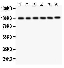 Anti-STIM1 Rabbit Polyclonal Antibody