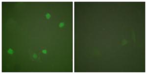 Immunofluorescence analysis of COS7 cells using Anti-HDAC3 Antibody. The right hand panel represents a negative control, where the antibody was pre-incubated with the immunising peptide.