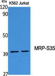 Western blot analysis of various cells using Anti-MRPS35 Antibody