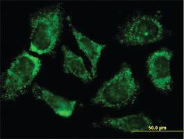 Anti-MOGAT3 Mouse Monoclonal Antibody [clone: 3F7]