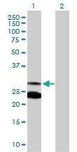 Anti-MRRF Rabbit Polyclonal Antibody