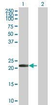 Anti-PYCARD Mouse Polyclonal Antibody