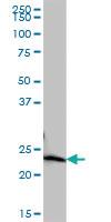 Anti-COMMD10 Mouse Polyclonal Antibody