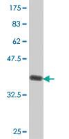 Anti-ATP12A Mouse Polyclonal Antibody