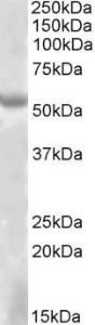 Anti-EYA1 Antibody (A83140) (2µg/ml) staining of HEK293 lysate (35µg protein in RIPA buffer). Primary incubation was 1 hour. Detected by chemiluminescence.