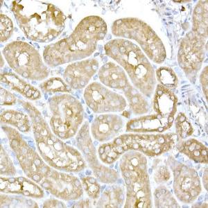 Immunohistochemistry analysis of paraffin-embedded mouse kidney using Anti-IRE1 Antibody (A92812) at a dilution of 1:100 (40x lens) Perform high pressure antigen retrieval with 10 mM citrate buffer pH 60 before commencing with IHC staining protocol