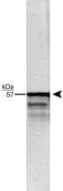 Anti-PRPH Rabbit Polyclonal Antibody